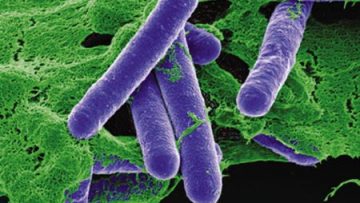 BotulismoClostridium Botulinum BacteriaC: Corbis/Stock Photos
